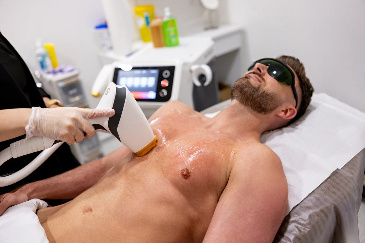 Man getting laser hair removal