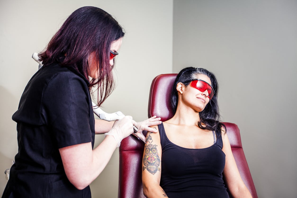 woman getting tattoo removal