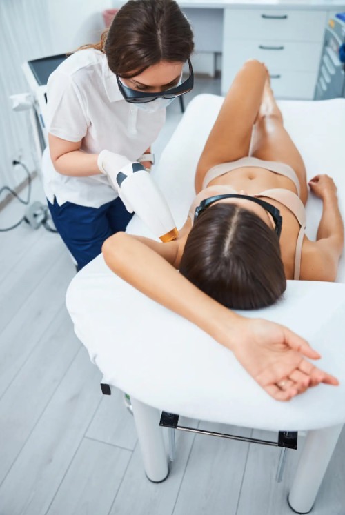 underarm laser hair removal