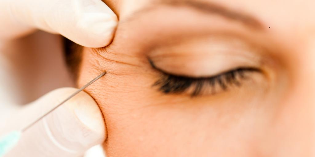 When Should You Start Getting Botox Age Guidelines and Prevention Tips